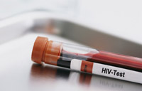 HIV-Test, © Grafikstelle Stormarn