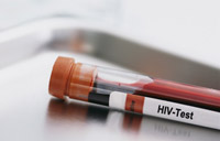 HIV-Test